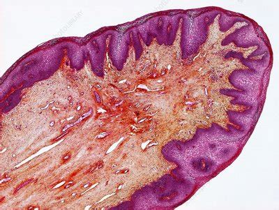 hymen foto|Hymen Photos Science Photo Library